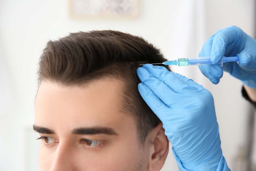 Hair Transplant Turkey – Your Trusted Solution for Hair Loss