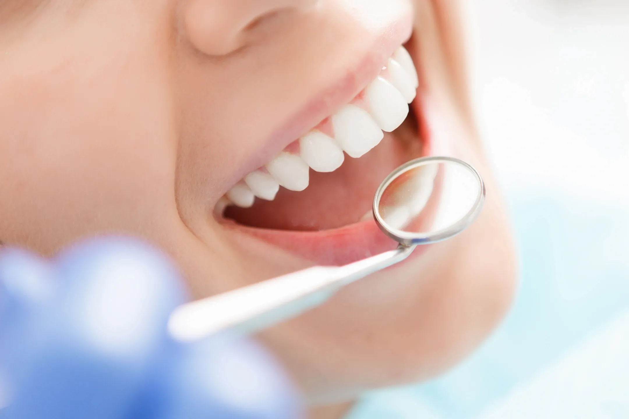 Achieving a Perfect Smile with Level Orthodontics North Expertise