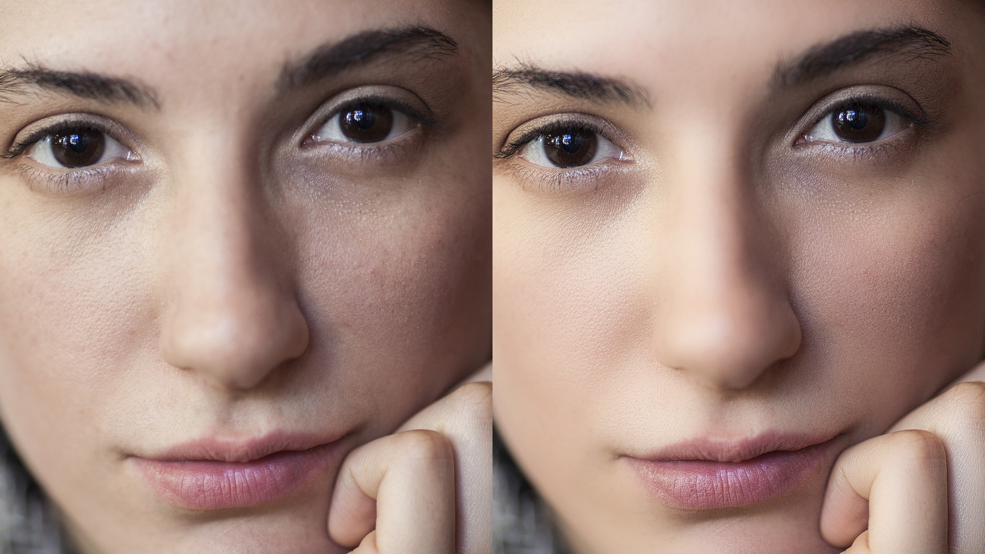 Gilmore Health News Report – The Hidden Psychological Impact of Beauty Filters