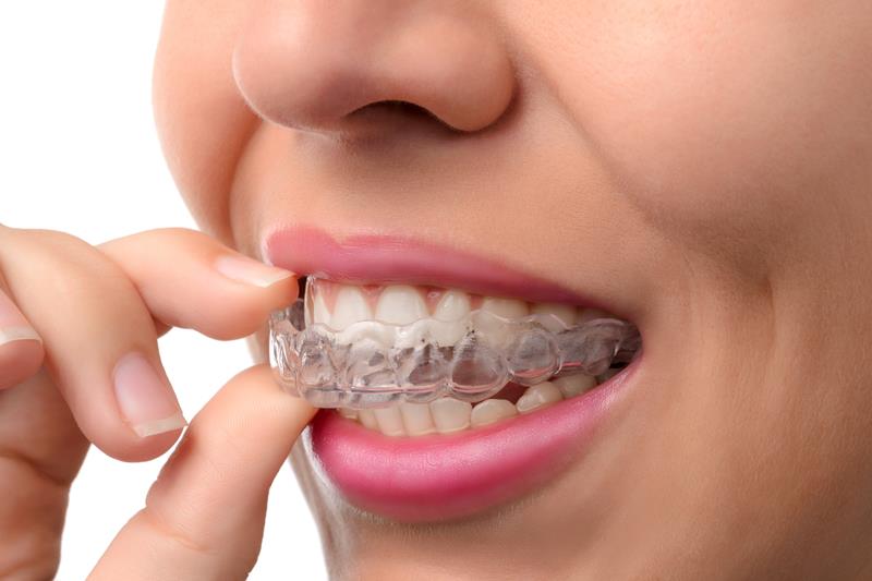 Finding the Best Dental Clinic in Chennai: Your Comprehensive Guide